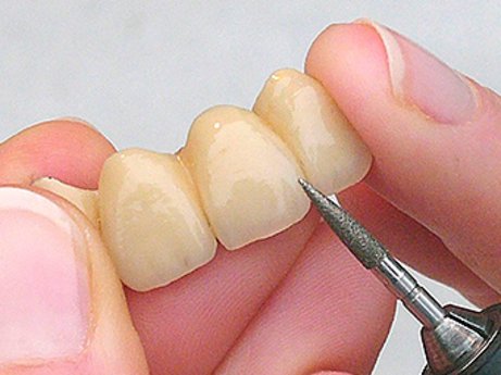 WILOFA® Formschleifer beim Einsatz